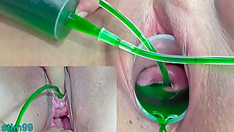 Japanese Lesbians Experiment With Gynecological And Urinary Pleasure Through Injections